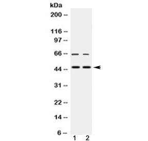 Western blot testing of 1) rat testis and 2) human HeLa lysate with MPI antibody at 0.5ug/ml. Predic