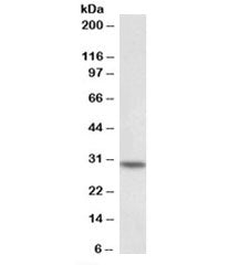 Western blot testing of peripheral blood lymphocyte lysate with HOXC8 antibody at 0.1ug/ml. Expected