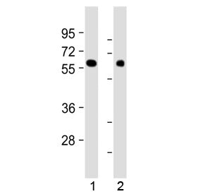 MKS1 Antibody / Meckel syndrome type 1 protein (N-Terminal Region)