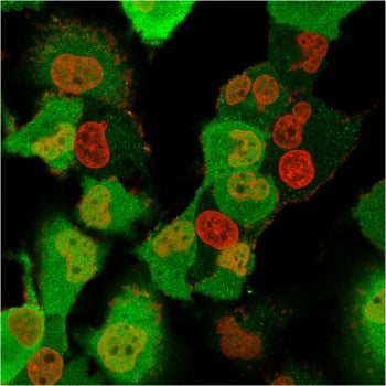 IF/ICC testing of fixed and permeabilized human T98G cells with FSP1 antibody (clone CPTC-S100A4-3, 