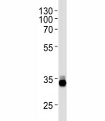 OTX2 Antibody