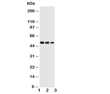 Kallistatin Antibody