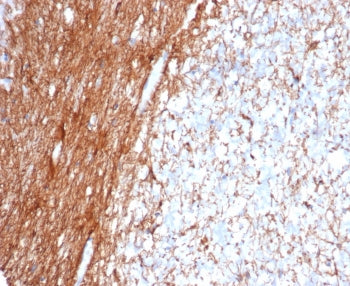 IHC staining of FFPE human cerebellum tissue with Glial Fibrillary Acidic Protein antibody (clone GF