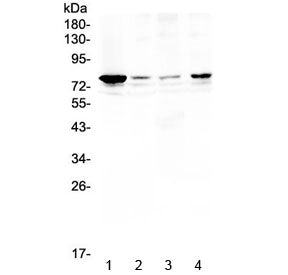 RANK Antibody