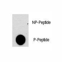 NFATC2 Antibody (phospho-S330)