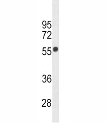 CB1 Antibody (Cannabinoid Receptor 1)