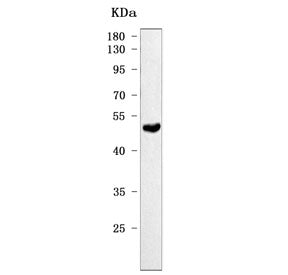 Kcnn4 Antibody / Kca3.1 / Skca4