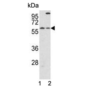 Western blot testing of 1) mouse liver and 2) human HepG2 cell lysate with Cryptochrome 2 antibody. 