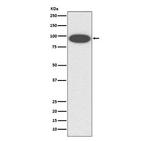 CD18 Antibody / ITGB2 / LFA-1