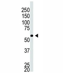 BACE2C Antibody