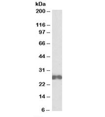 Western blot testing of Jurkat lysate with D4-GDI antibody at 0.1ug/ml. Predicted molecular weight: 