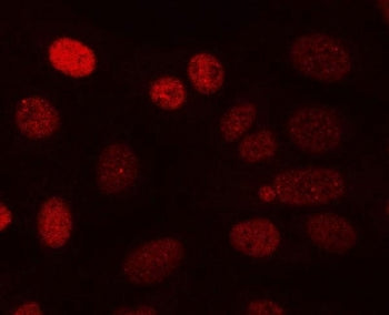 Calcineurin Antibody / PPP3CA