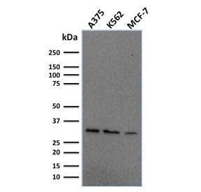 Western blot testing of human A375, K562 and MCF7 cell lysate with RPA32 antibody. Expected molecula