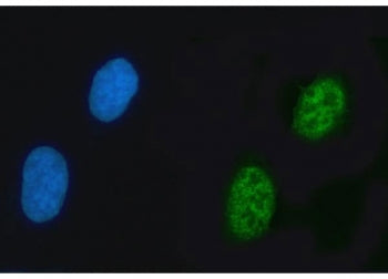 ZNF609 Antibody / KIAA0295