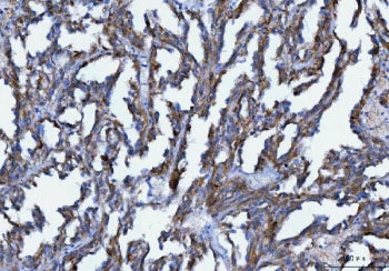 AXIN2 Antibody / Axis inhibition protein 2