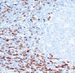 IHC analysis of FFPE human tonsil and CD8a antibody (clone CLDA8a-1). Staining of formalin-fixed tis