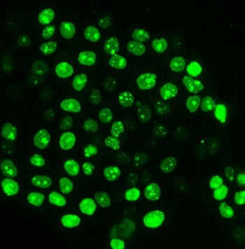 Immunofluorescent staining of FFPE human A431 cells with Ki67 antibody. HIER: steam section in pH6 c