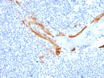 IHC staining of FFPE human tonsil tissue with KRT16 antibody (clone SPM264). HIER: boil tissue secti