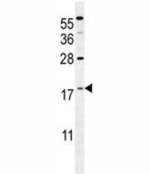 S100A4 Antibody