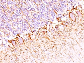 Neurofilament Antibody (-Heavy) / NF-H / NEFH