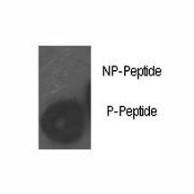 Retinoblastoma / Rb Antibody (phospho-S780)