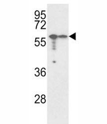 VIM Antibody