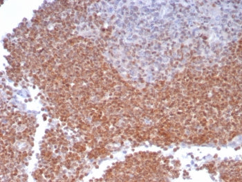 MGMT Antibody