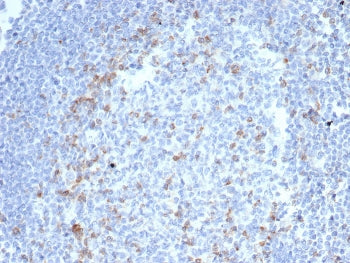 CTLA-4 Antibody / CD152