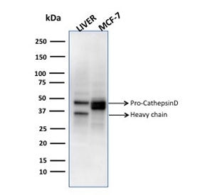 Western blot testing of human liver and MCF7 cell lysate with CTSD antibody.