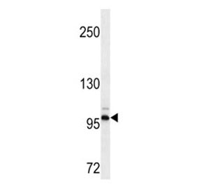 DDR2 Antibody