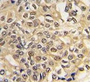UBA1 Antibody / E1 Ubiquitin activating enzyme
