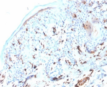S100A4 Antibody / FSP1