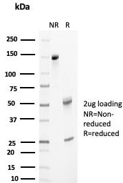 Clusterin Antibody / Apolipoprotein J / APO-J