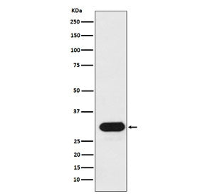 Western blot testing of human Ramos cell lysate with HLA-DRB1 antibody. Expected molecular weight ~3