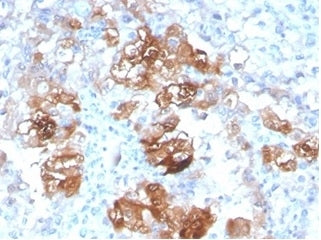 IHC staining of FFPE human kidney tissue with FABP1 antibody (clone FABP1/3940). HIER: boil tissue s