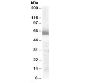 CYP17A1 Antibody