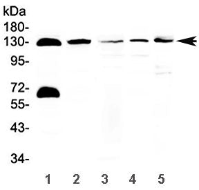 NEDD4-2 Antibody / NEDD4L