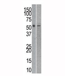 Reptin Antibody