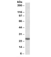 ARHGDIG Antibody