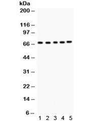 Western blot testing of 1) rat kidney, 2) mouse liver, 3) human HeLa, 4) PANC and 5) COLO320 lysate 