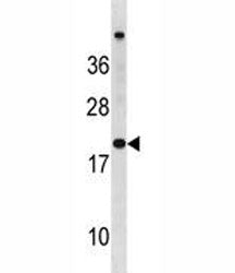 CDKN2A Antibody