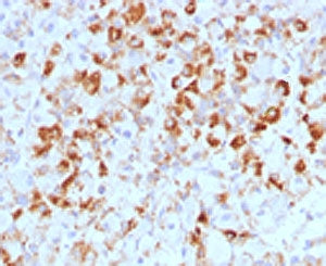 Luteinizing Hormone beta Antibody