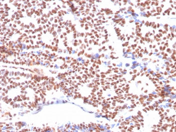 Estrogen Receptor alpha Antibody