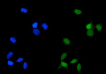 Immunofluorescent staining of FFPE human HeLa cells with PPP2CA antibody (green) and DAPI nuclear st