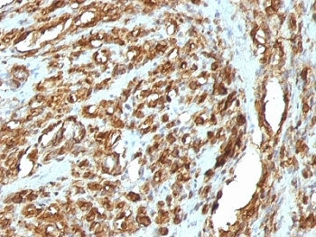 Actin Antibody Cocktail (pan muscle)