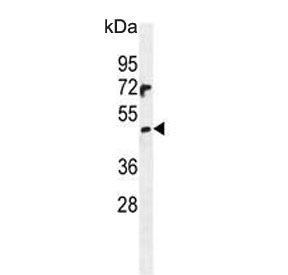 PRAMEF6 Antibody