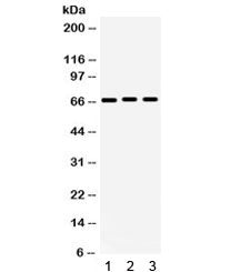 Western blot testing of human 1) 293, 2) A549 and 3) PANC cell lysate with KCNA5 antibody. Expected/