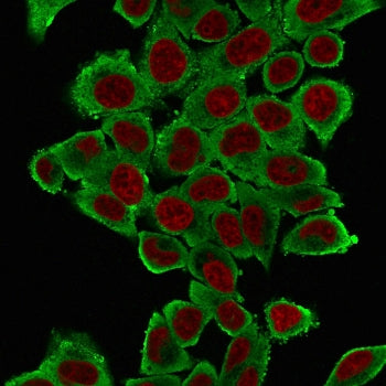 Immunofluorescent staining of fixed human HeLa cells with Smooth Muscle Actin antibody (clone 1A4, g