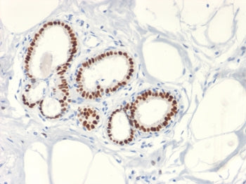 Estrogen Receptor alpha Antibody
