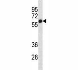 Alkaline Phosphatase Antibody (placental)